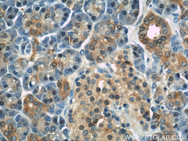 RBP1 Antibody in Immunohistochemistry (Paraffin) (IHC (P))