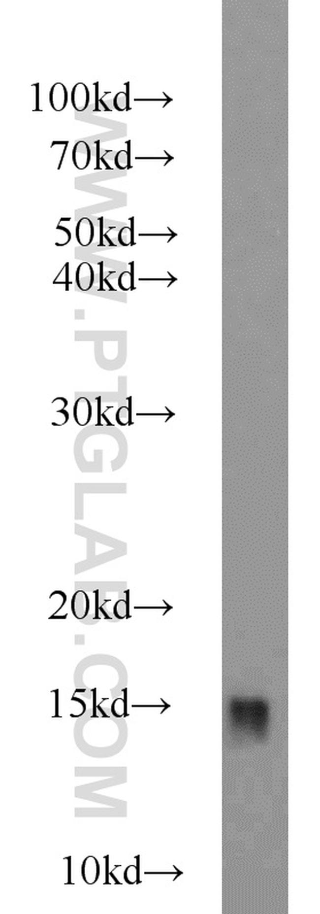 RBP1 Antibody in Western Blot (WB)