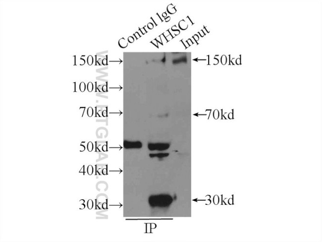 WHSC1 Antibody in Immunoprecipitation (IP)