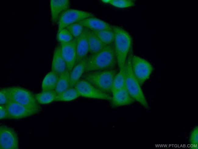 CCS Antibody in Immunocytochemistry (ICC/IF)