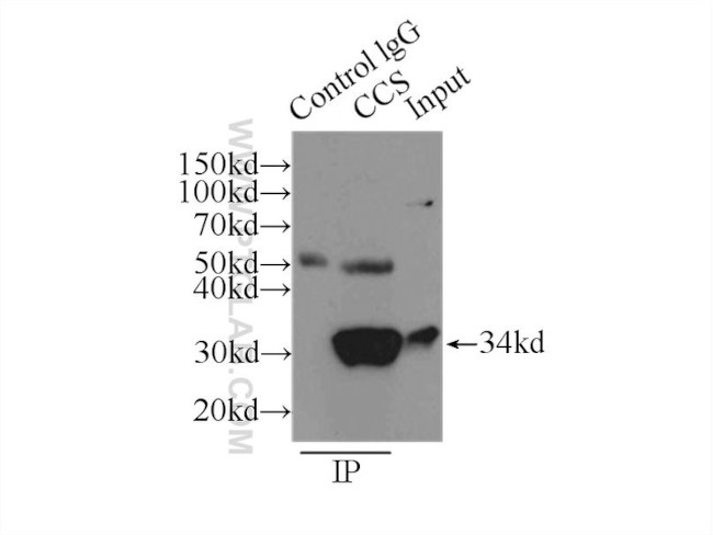 CCS Antibody in Immunoprecipitation (IP)