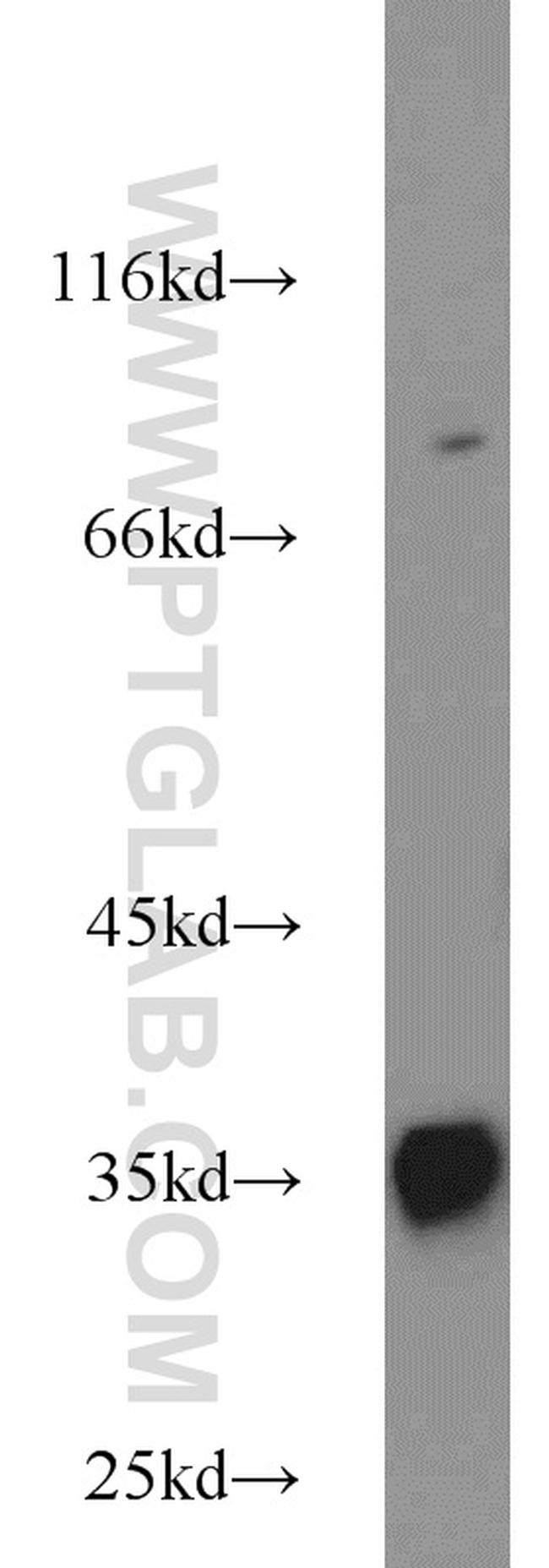 CCS Antibody in Western Blot (WB)