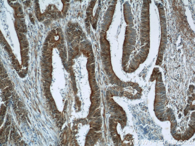 B3GNT7 Antibody in Immunohistochemistry (Paraffin) (IHC (P))