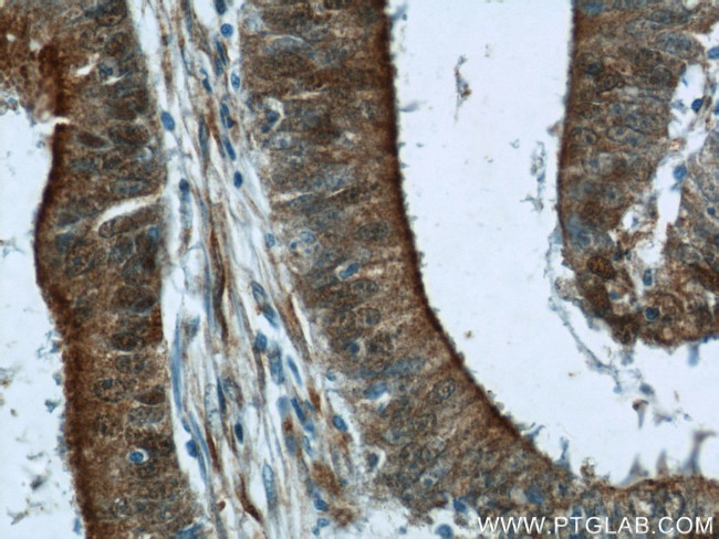 B3GNT7 Antibody in Immunohistochemistry (Paraffin) (IHC (P))