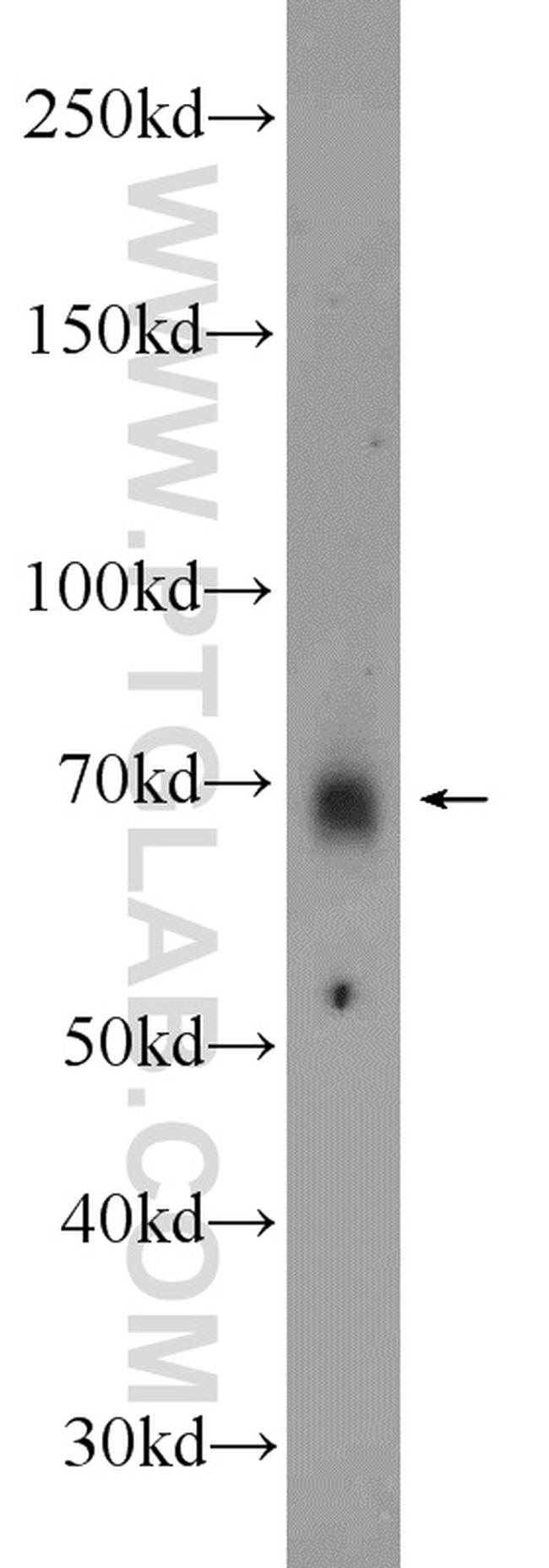 MEX3C Antibody in Western Blot (WB)