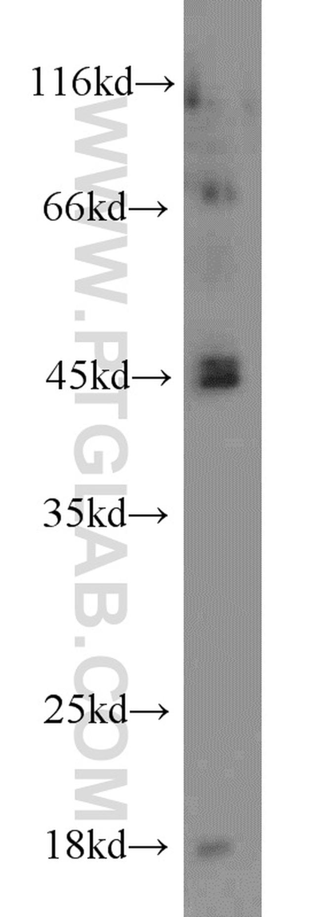 Caspase 1/p20/p10 Antibody in Western Blot (WB)