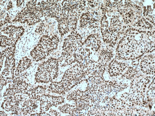 PARP1 Antibody in Immunohistochemistry (Paraffin) (IHC (P))