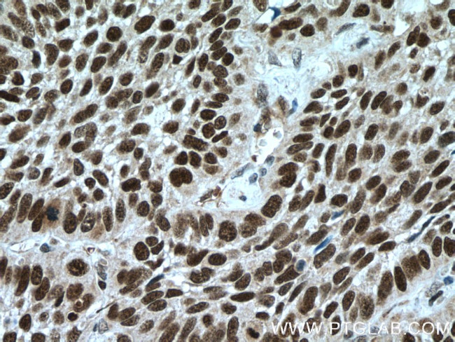 PARP1 Antibody in Immunohistochemistry (Paraffin) (IHC (P))