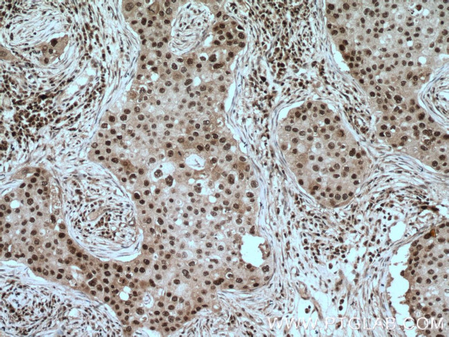 PARP1 Antibody in Immunohistochemistry (Paraffin) (IHC (P))