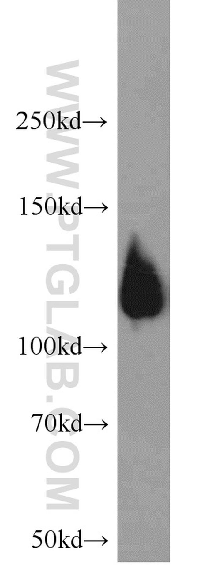 PARP1 Antibody in Western Blot (WB)