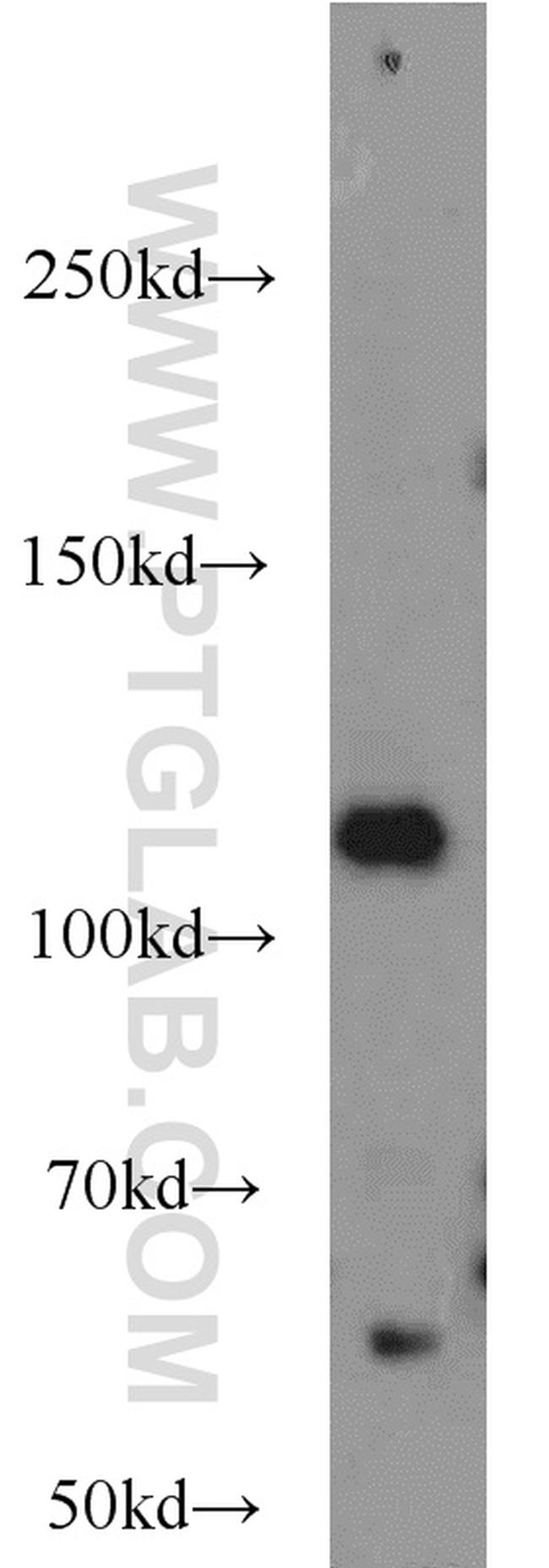 PARP1 Antibody in Western Blot (WB)