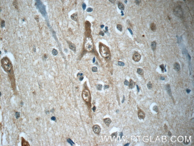 SORCS1 Antibody in Immunohistochemistry (Paraffin) (IHC (P))