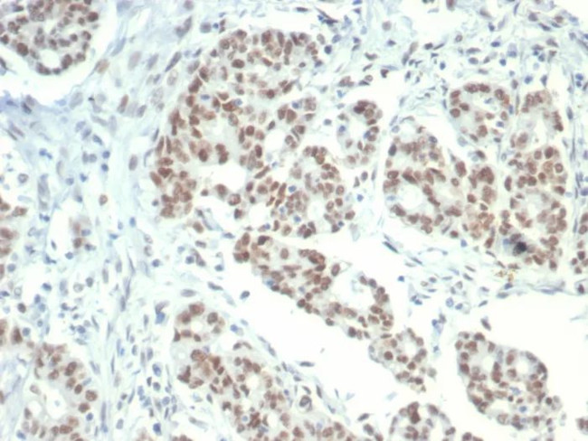 KDM1A (Nuclear Marker and Transcription Factor) Antibody in Immunohistochemistry (Paraffin) (IHC (P))