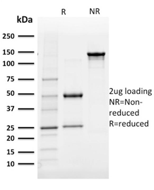Aldo-keto Reductase Family 1 Member B1 Antibody in SDS-PAGE (SDS-PAGE)