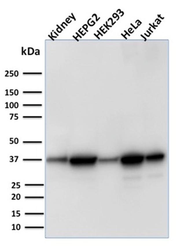 Aldo-keto Reductase Family 1 Member B1 Antibody in Western Blot (WB)