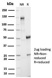 Aldo-keto Reductase Family 1 Member B1 (Adrenal Marker) Antibody in SDS-PAGE (SDS-PAGE)