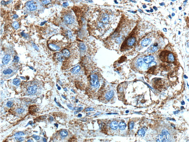 BEND3 Antibody in Immunohistochemistry (Paraffin) (IHC (P))