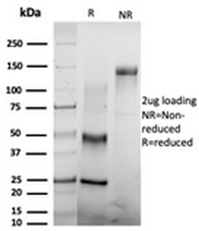 CSTF2T (Transcription Factor) Antibody in SDS-PAGE (SDS-PAGE)