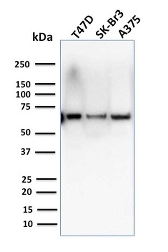 CSTF2T (Transcription Factor) Antibody in Western Blot (WB)