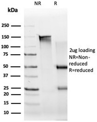 UBR2/E3 ubiquitin-protein ligase UBR2 (Transcription Factor) Antibody in SDS-PAGE (SDS-PAGE)