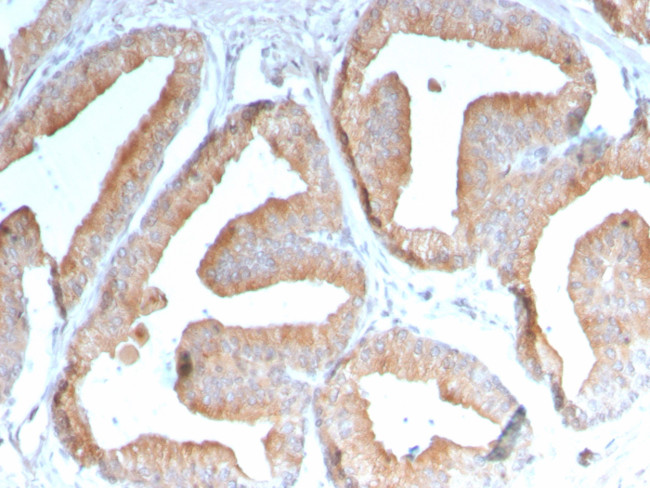 ICOS-L/ICOS Ligand/B7RP-1 (Immuno-Oncology Target) Antibody in Immunohistochemistry (Paraffin) (IHC (P))