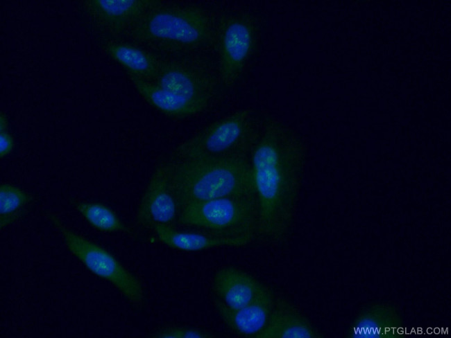 STAG3 Antibody in Immunocytochemistry (ICC/IF)