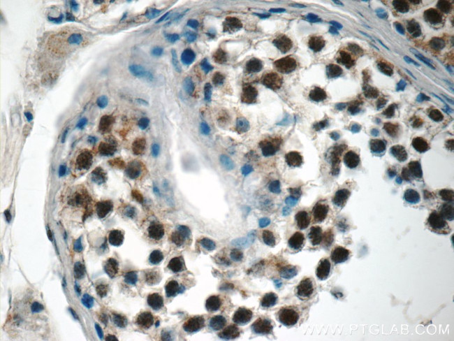 STAG3 Antibody in Immunohistochemistry (Paraffin) (IHC (P))