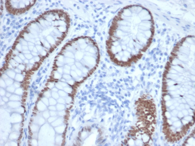 SATB2 (Colorectal Carcinoma Marker) Antibody in Immunohistochemistry (Paraffin) (IHC (P))