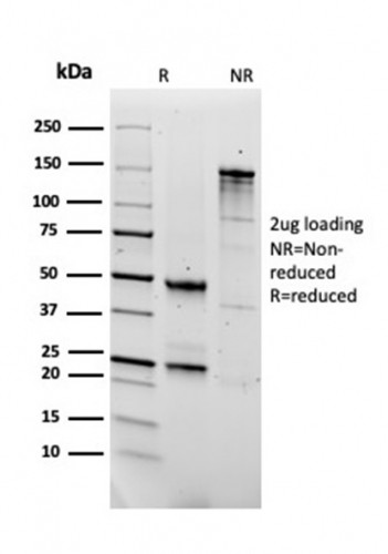 Fibronectin Antibody in SDS-PAGE (SDS-PAGE)