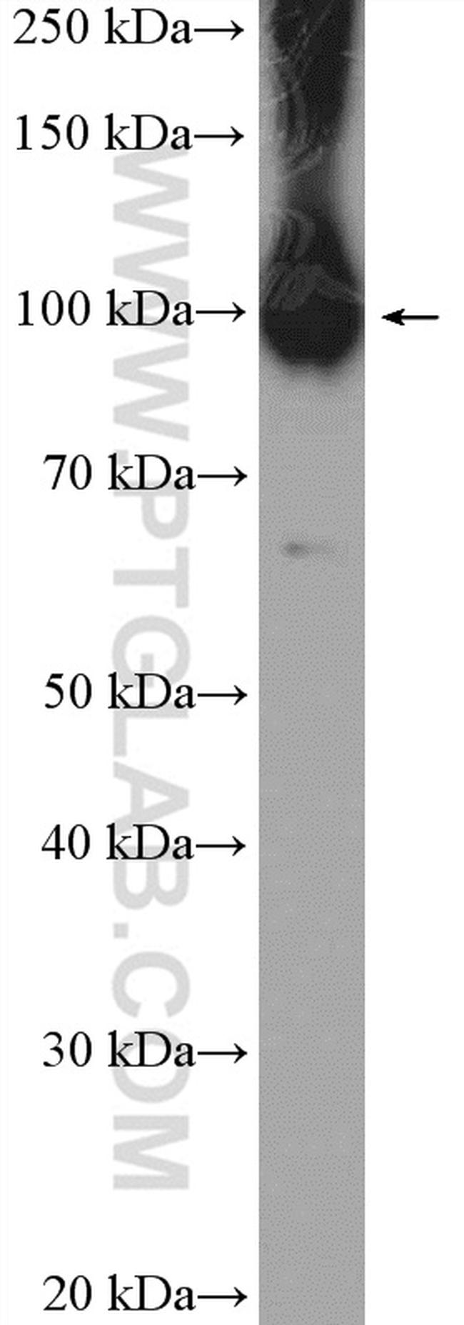 ZCCHC8 Antibody in Western Blot (WB)