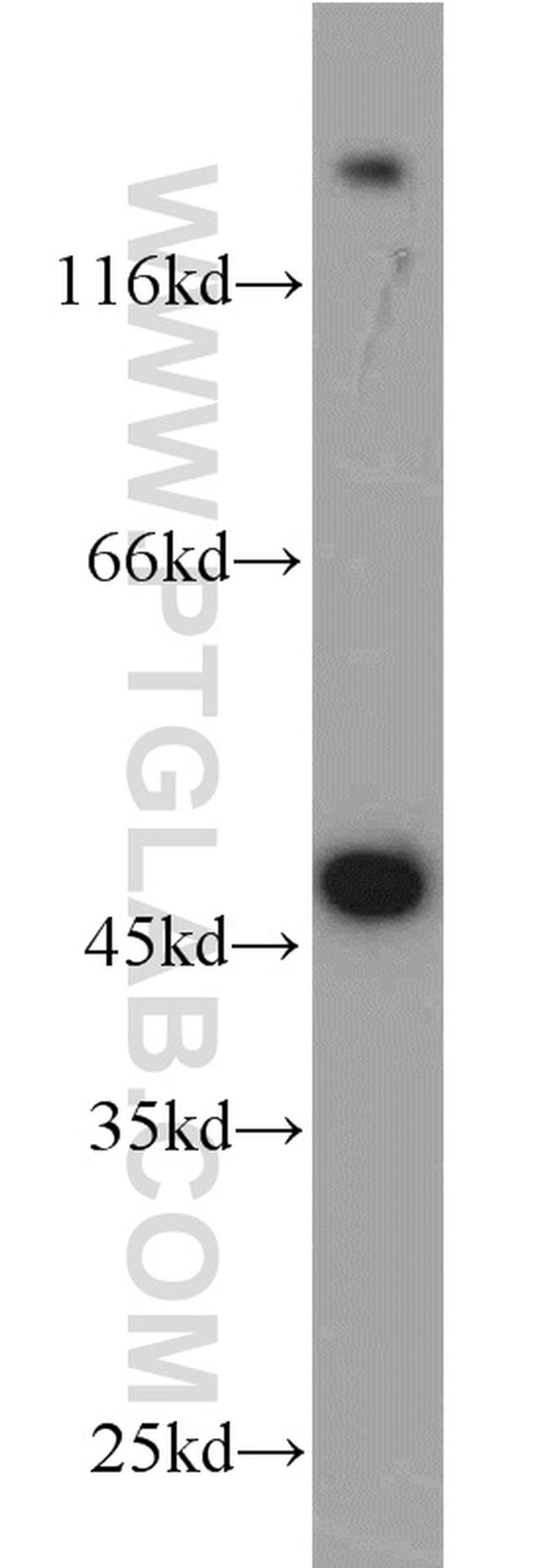 ADH7 Antibody in Western Blot (WB)