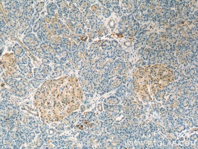 Ubiquilin 1 Antibody in Immunohistochemistry (Paraffin) (IHC (P))