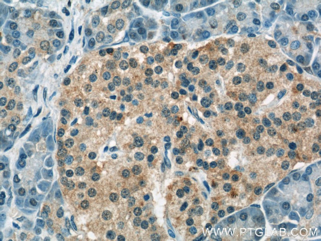 Ubiquilin 1 Antibody in Immunohistochemistry (Paraffin) (IHC (P))