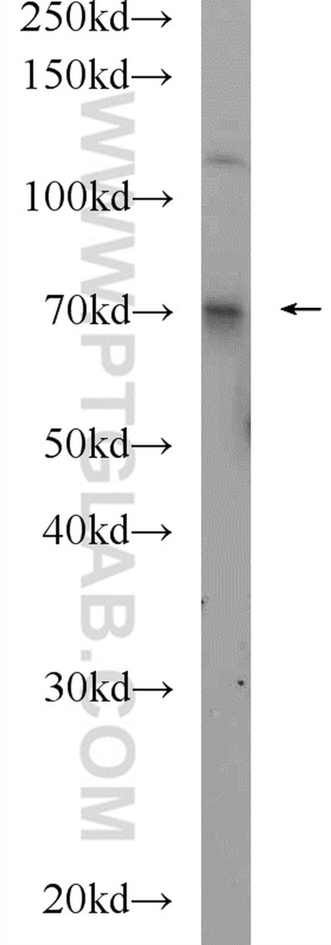 Ubiquilin 1 Antibody in Western Blot (WB)