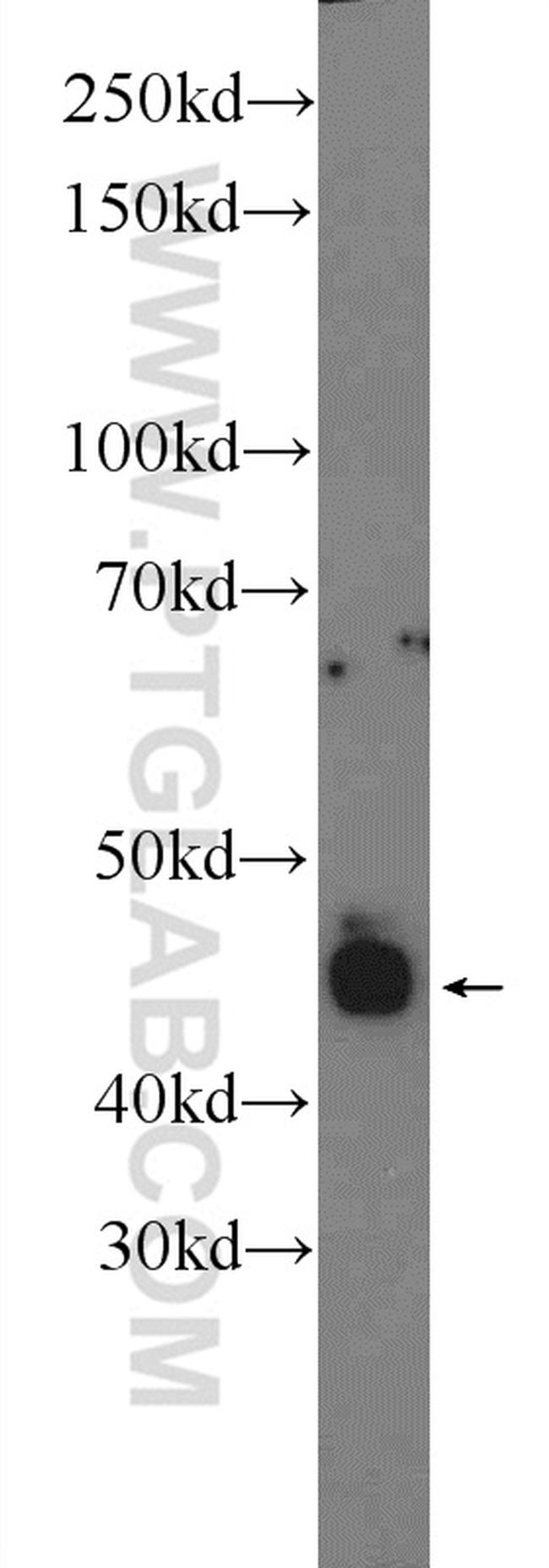 Retinal S antigen Antibody in Western Blot (WB)