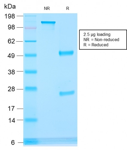 AMACR/p504S (Prostate Cancer Marker) Antibody in SDS-PAGE (SDS-PAGE)