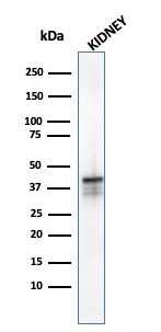AMACR/p504S (Prostate Cancer Marker) Antibody in Western Blot (WB)