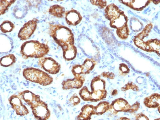 AMACR/p504S (Prostate Cancer Marker) Antibody in Immunohistochemistry (Paraffin) (IHC (P))