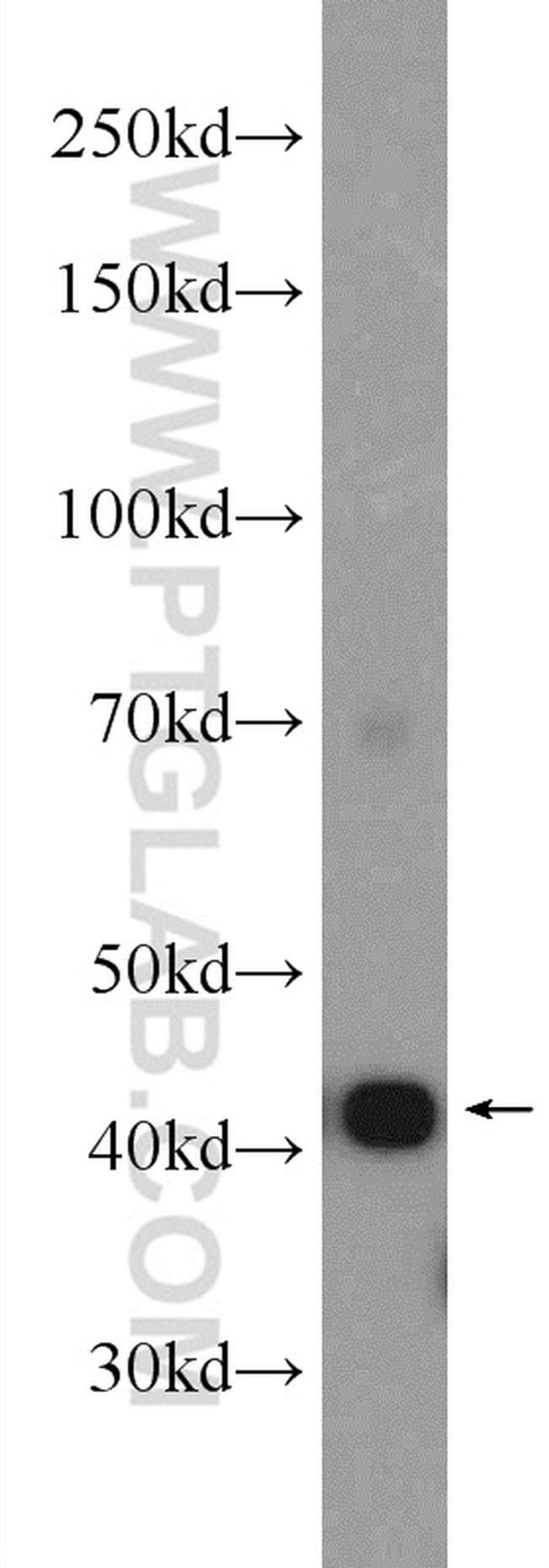 alpha Actin Antibody in Western Blot (WB)