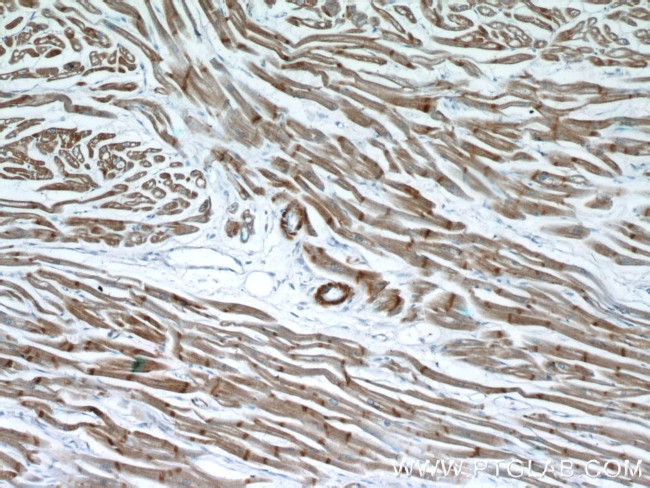 alpha Actin Antibody in Immunohistochemistry (Paraffin) (IHC (P))