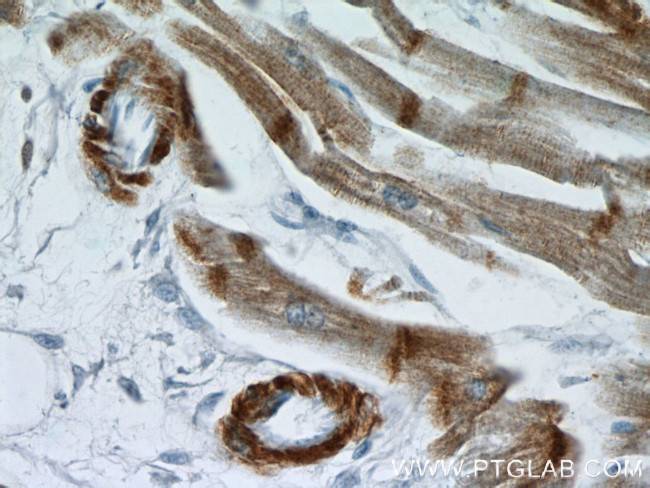 alpha Actin Antibody in Immunohistochemistry (Paraffin) (IHC (P))