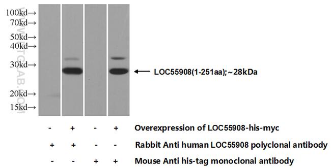 ANGPTL8/Betatrophin Antibody in Western Blot (WB)