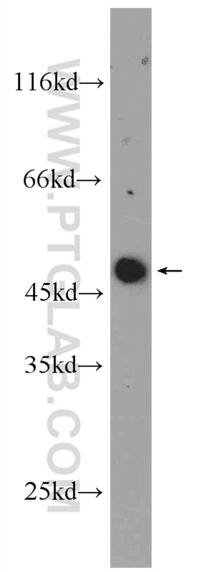 ARCN1 Antibody in Western Blot (WB)