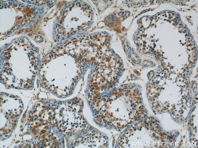 ARCN1 Antibody in Immunohistochemistry (Paraffin) (IHC (P))