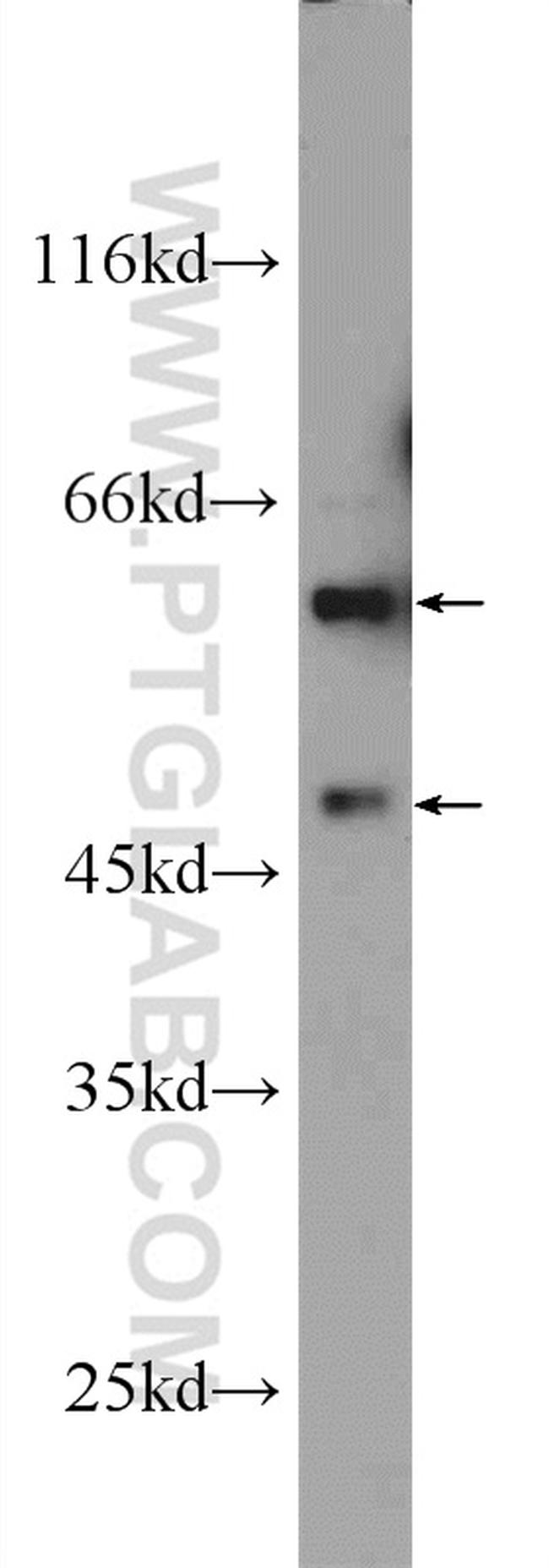 ARCN1 Antibody in Western Blot (WB)