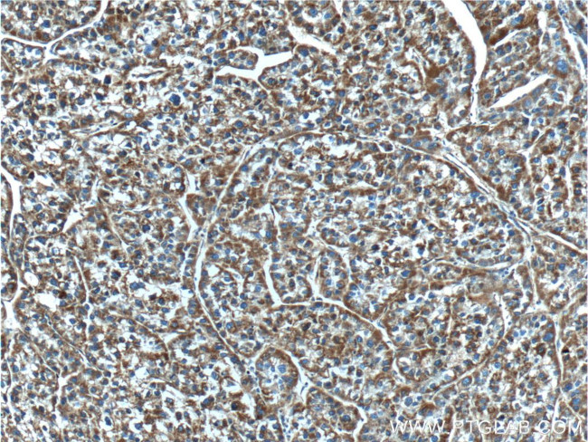 NDUFB5 Antibody in Immunohistochemistry (Paraffin) (IHC (P))