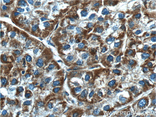 NDUFB5 Antibody in Immunohistochemistry (Paraffin) (IHC (P))