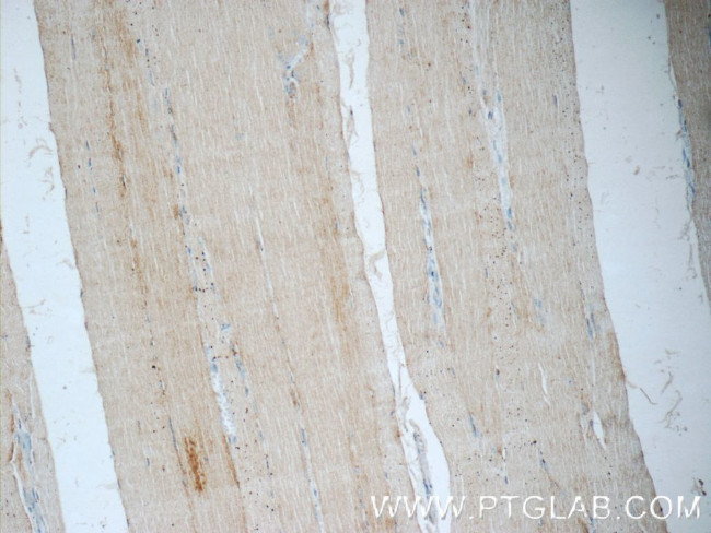 MYOZ3 Antibody in Immunohistochemistry (Paraffin) (IHC (P))