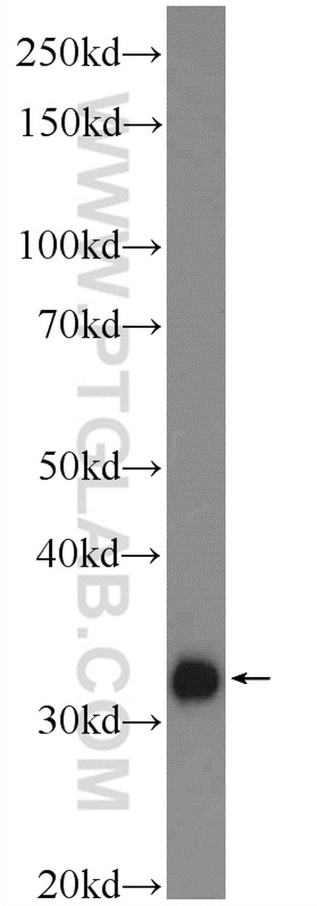 MYOZ3 Antibody in Western Blot (WB)