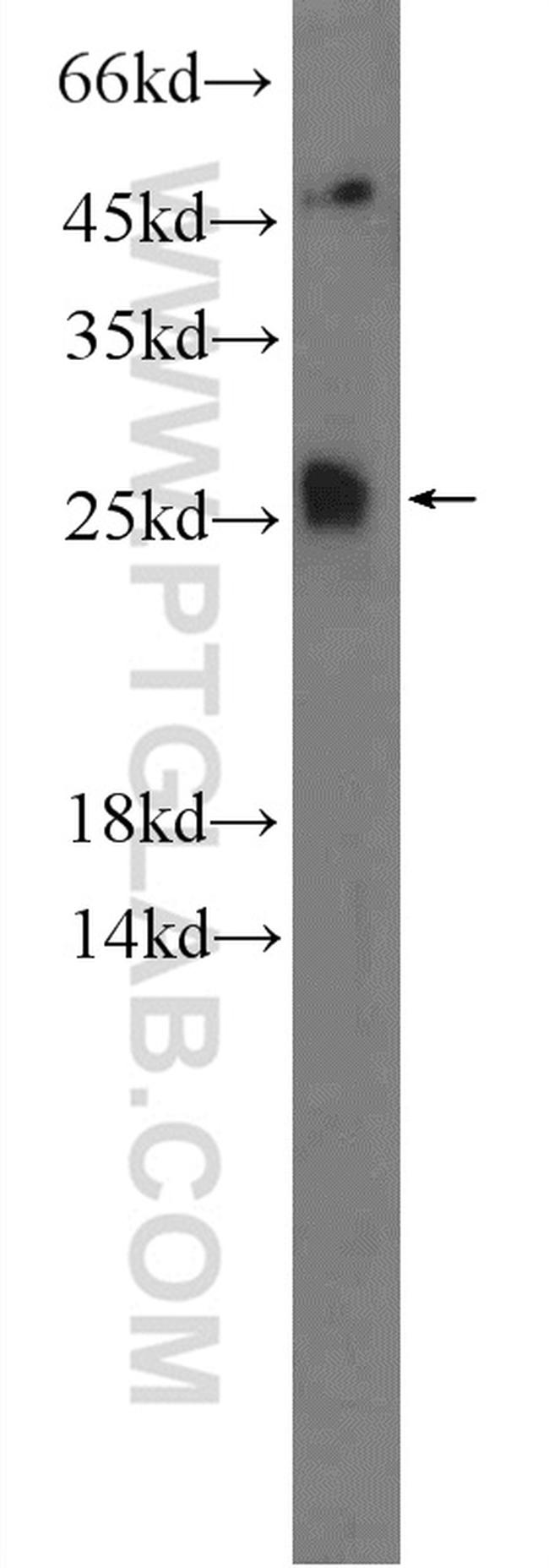 TMEM208 Antibody in Western Blot (WB)